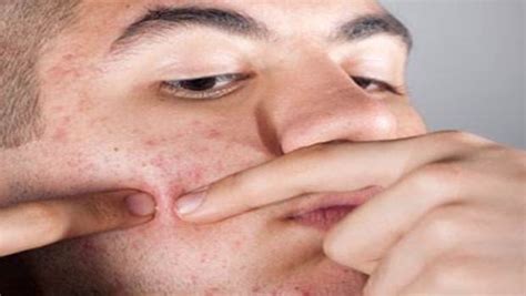 What Does Skin Cancer Look Like On Face