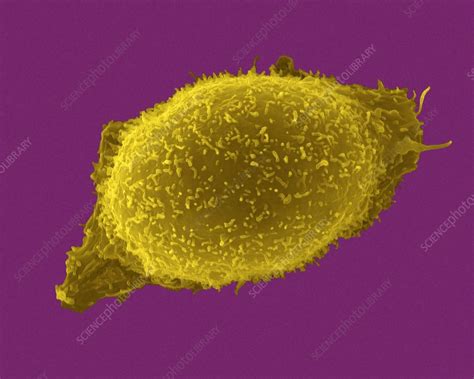 Mast Cell Sem Stock Image C0319749 Science Photo Library