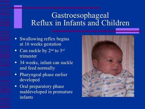 Acid Reflux And Gerd In Babies Symptoms And Causes Treatment And