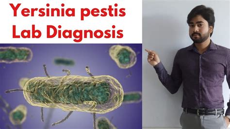 Yersinia Pestis Lab Diagnosis By Abhishek Sir Youtube