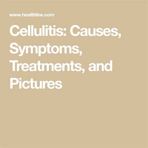 Cellulitis Causes Symptoms Treatments And Pictures Treatment