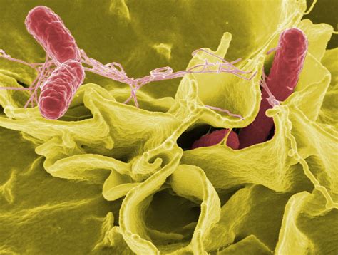 Bakteria Salmonelli Jest Pasożytem Zewnętrznym - Salmonella pomaga zabić raka. Świetne wyniki testów - o2 - Serce Internetu