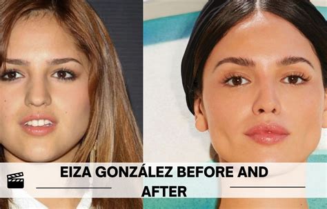 Eiza Gonz Lez Before And After Surgery Look Check Out Her Incredible