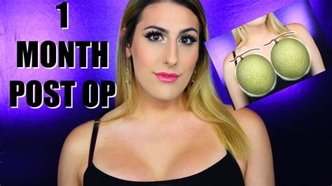 Month Post Op Breast Augmentation Transgender Edition YouTube