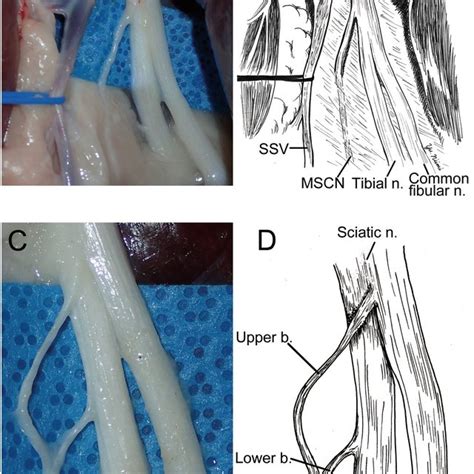 The Surgical Anatomy Of Medial Sural Cutaneous Nerve Mscn Ab To