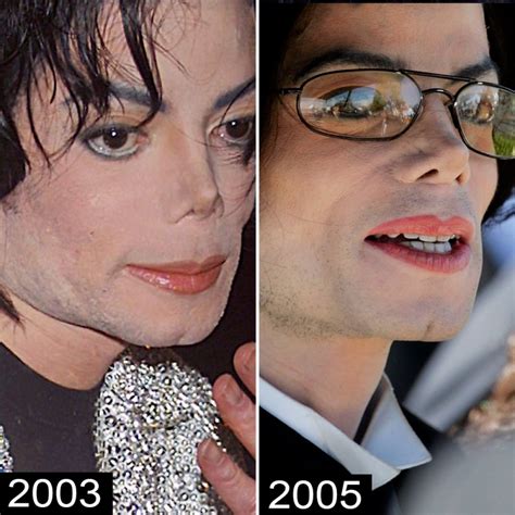 Michael Jackson S Before And After Plastic Surgery Nose Jobs Face And