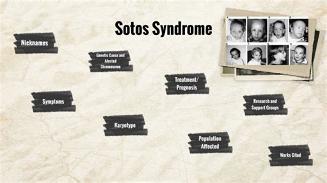 Sotos Syndrome By Estephanie Valenzuela