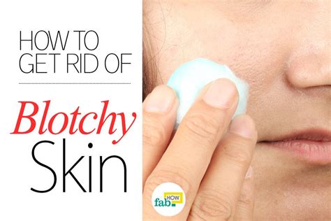 How To Get Rid Of Blotchy Skin With Natural Home Remedies Fab How