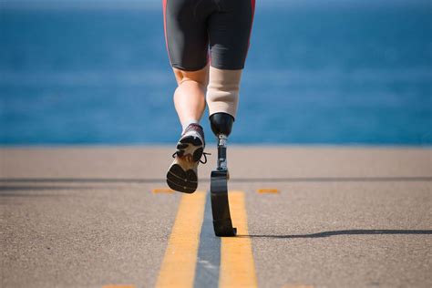 5 Inspirational Athletes With Prosthetic Devices