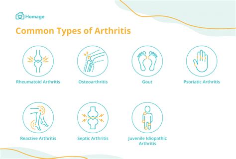 Arthritis 101 Causes Symptoms Types And Treatment Homage