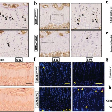 bmal1 ablation affected chondrocytes proliferation differentiation and download scientific