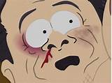 Lice Episode South Park Images