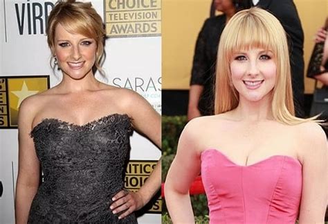 Melissa Rauch Breast Implants And Reductions Before And After Plastic Surgery Pictures
