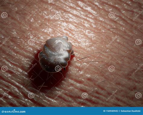 A Scabies Mite Stock Image Image Of Rendered Medically