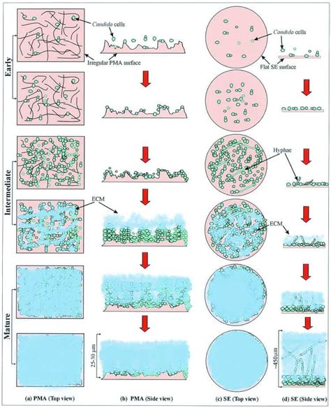 Biofilm Formation By The Fungal Pathogen Candida Albicans Development