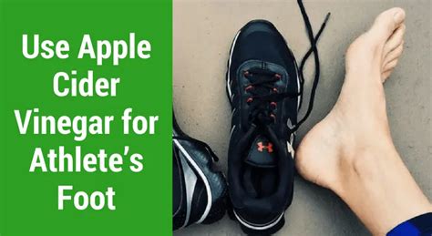 Use Apple Cider Vinegar For Athletes Foot 10 Easy Ways Wellnessguide