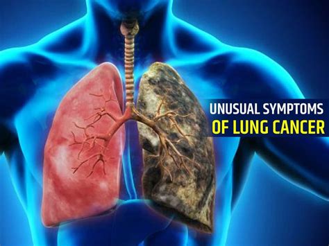 Warning Signs Of Lung Cancer