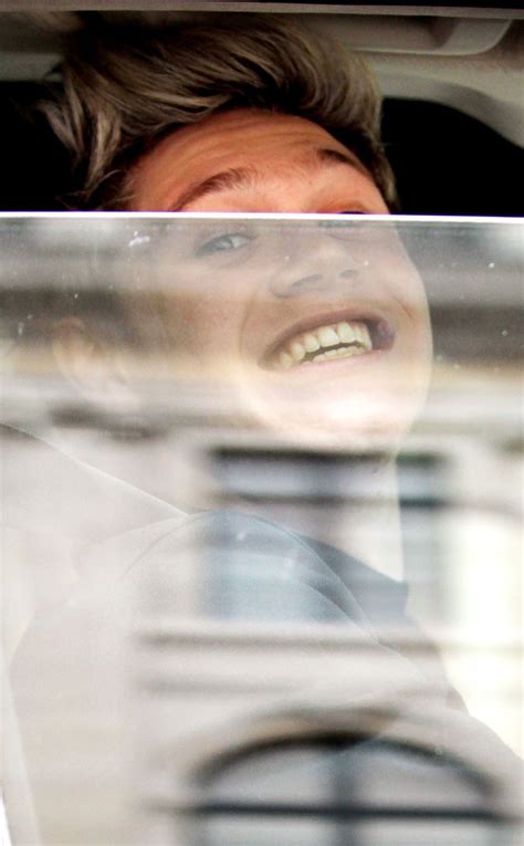 1ds Niall Horan Gets His Braces Off—see Before And After E Online