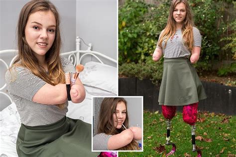 girl 14 who lost her arms and legs to meningitis becomes youtube make up blogger the