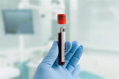 Blood Test Detects Toxic Alzheimers Protein Years Before Symptoms