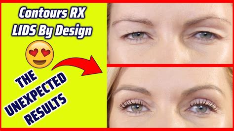 🤔do Contours Rx Lids Work Change The Way You Look🔥 With Contours Rx