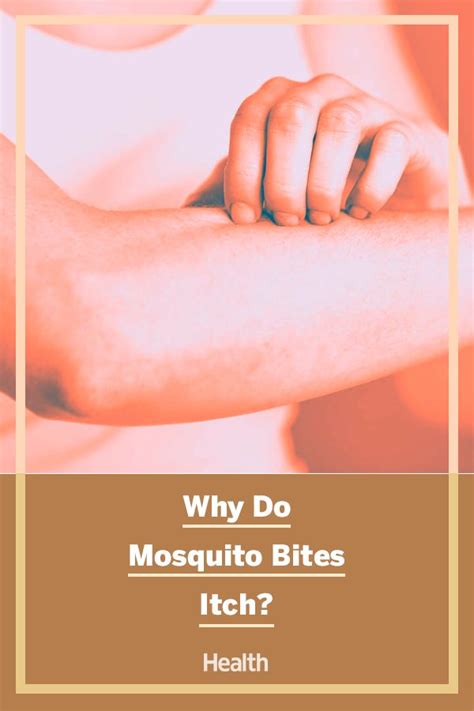 Heres The Real Reason Why Mosquito Bites Itch So Much Mosquito Bite