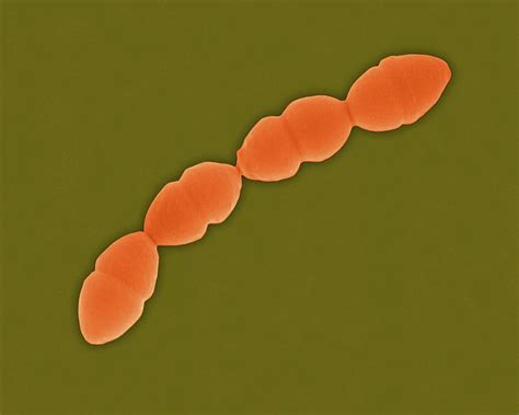 Streptococcus Pneumoniae Photograph By Dennis Kunkel Microscopyscience