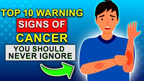 Top 10 Warning Signs Of Cancer Youtube