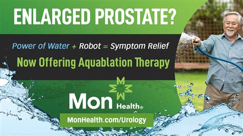 Mon Health Medical Center Introduces Aquablation Therapy Newsroom Welcome To Mon Health
