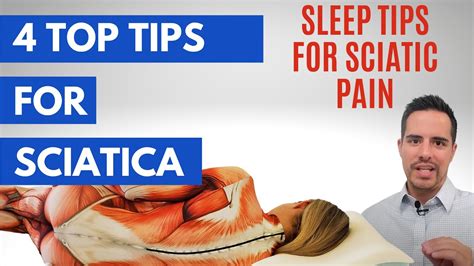 Doctor Shares 4 Tips For Sleeping With Sciatica Pain YouTube