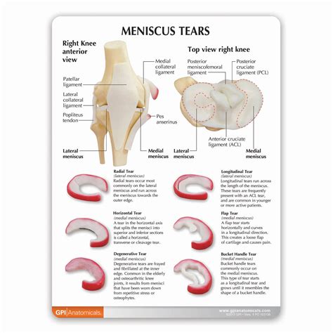 Knee Anatomy Torn Meniscus