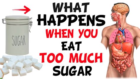 What Happens If You Eat Too Much Sugar Youtube