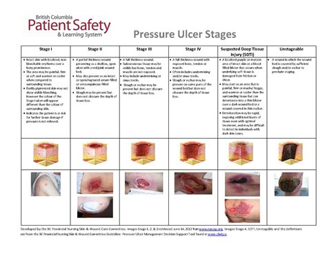 Continuing Education For Pressure Ulcer Prevention Taking The Pressure