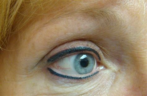 Eyeliner Tattooing Enhance Your Eyes With Permanent Makeup