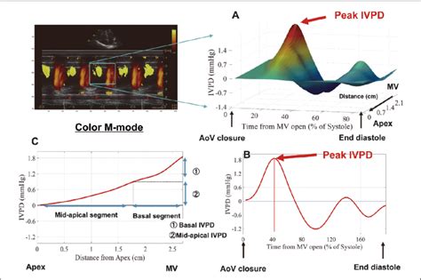 Estimation Of Early Diastolic Intraventricular Pressure Difference