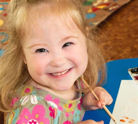 Angelman Syndrome Symptoms Causes And Cure Avaz Inc