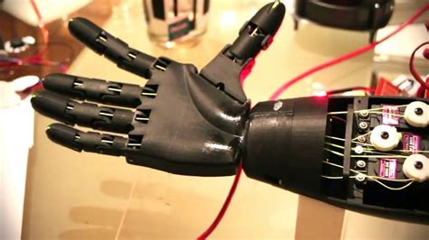 3d Printed Prosthetic Arm