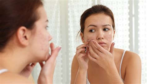 The 12 Best Acne Scar Treatments Of 2022 By Byrdie Acne Repair Cream