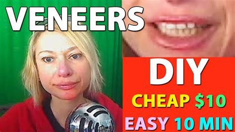 Check out our diy veneers selection for the very best in unique or custom, handmade pieces from our oral care shops. DIY VENEERS / CHEAP $10 / EASY 10 MIN / DIY AT HOME Update / Follow Up after 1 year use - YouTube