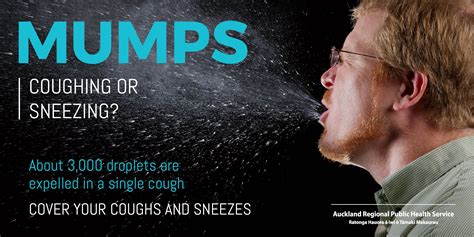 Mumps In Auckland Most Cases Reported In More Than Two Decades