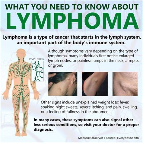 symptoms of lymphoma in neck symptoms of disease