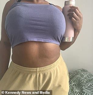 London Woman S K Breasts Won T Stop Growing Daily Mail Online