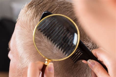 In clinical trials, less than 2% of men experienced sexual dysfunction due to finasteride. Hair and Hair Loss Treatment: The Story of Hair - Capillus