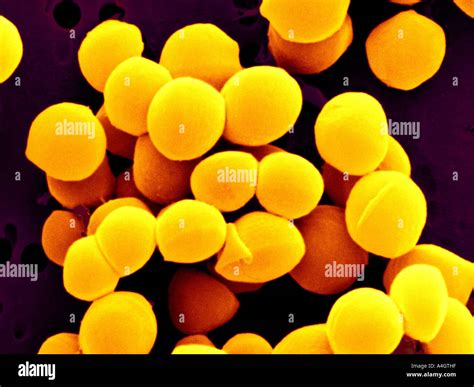 Staphylococcus Aureus Skin Hi Res Stock Photography And Images Alamy