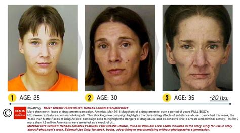 before and after pics of crystal meth users are enough to put you off for life metro news