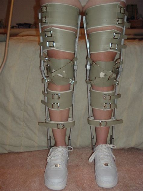 Smoked Elk Kafo Leg Braces Front View Flickr Photo Sharing