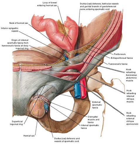 It pushes its way into the inguinal canal directly forwards through the posterior wall of the inguinal canal through the hesselbach's triangle (see below). Difference Between Direct and Indirect Inguinal Hernia| Direct vs. Indirect Inguinal Hernia