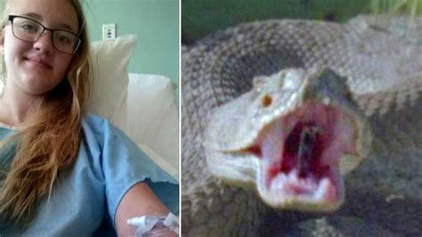 Teen Bit By Rattlesnake Keeps Her Cool And Saves Her Own Life Youtube