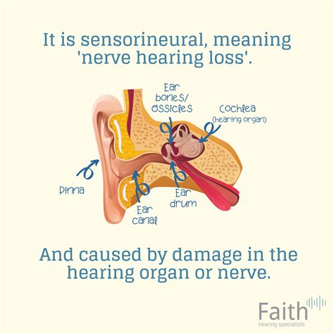 What is Sudden Sensorineural Hearing Loss/Sudden Deafness 