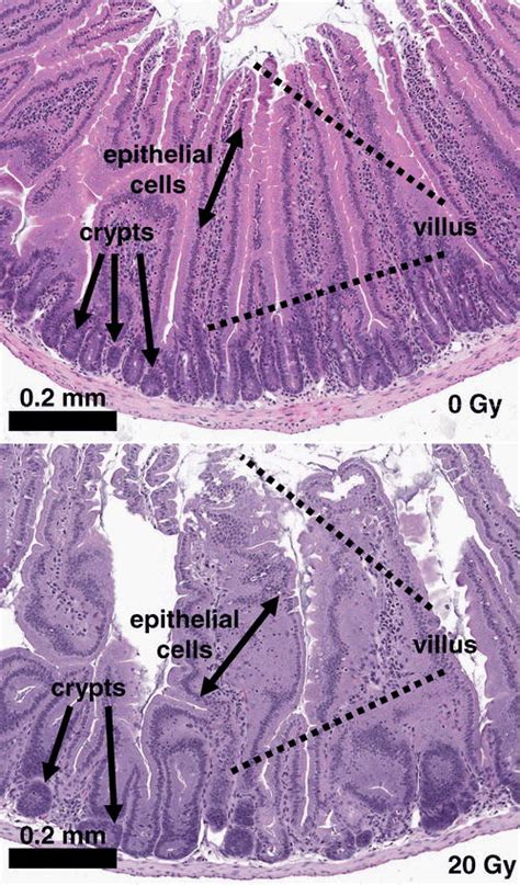 Small Intestine Histology Slides Labeled